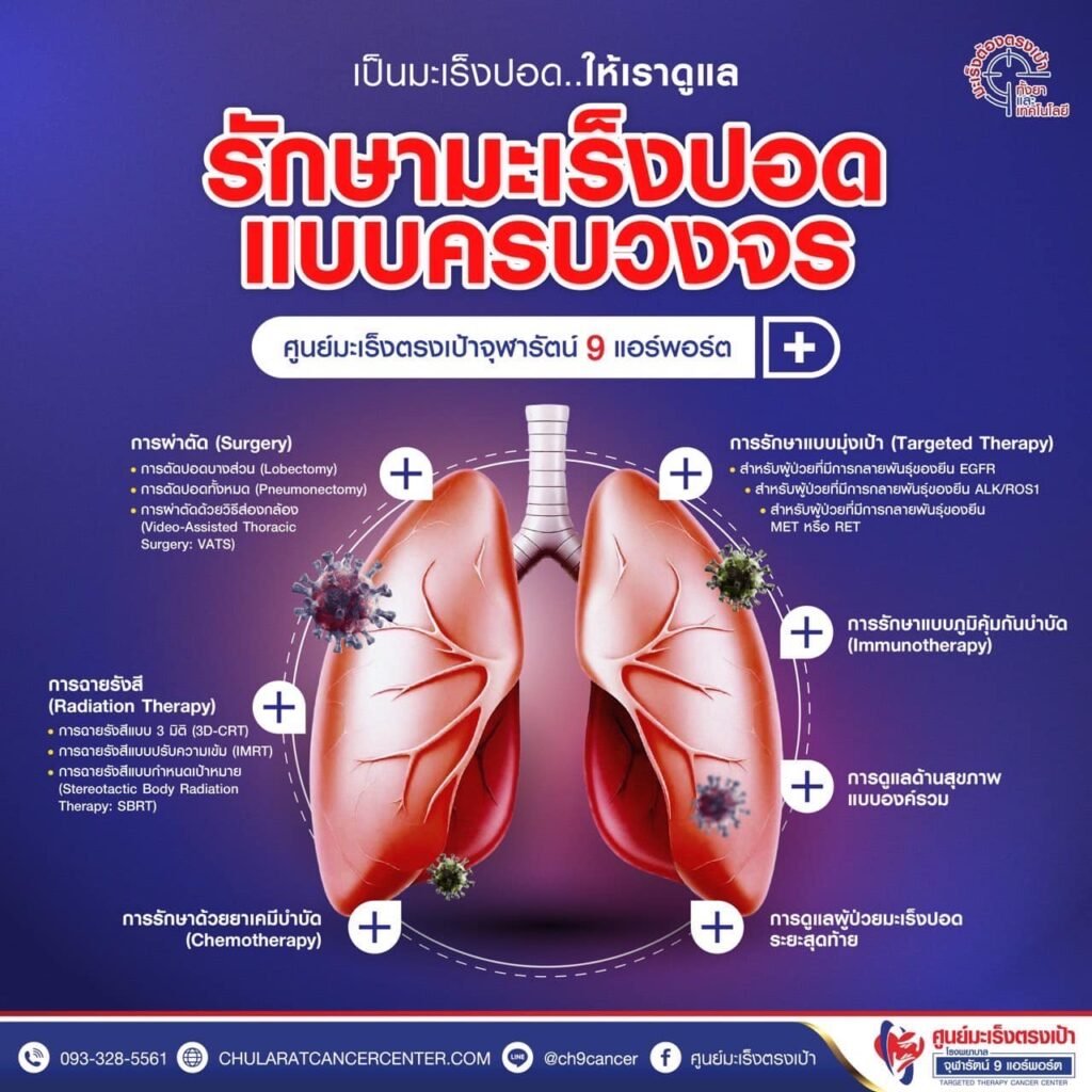 โรคมะเร็งปอด